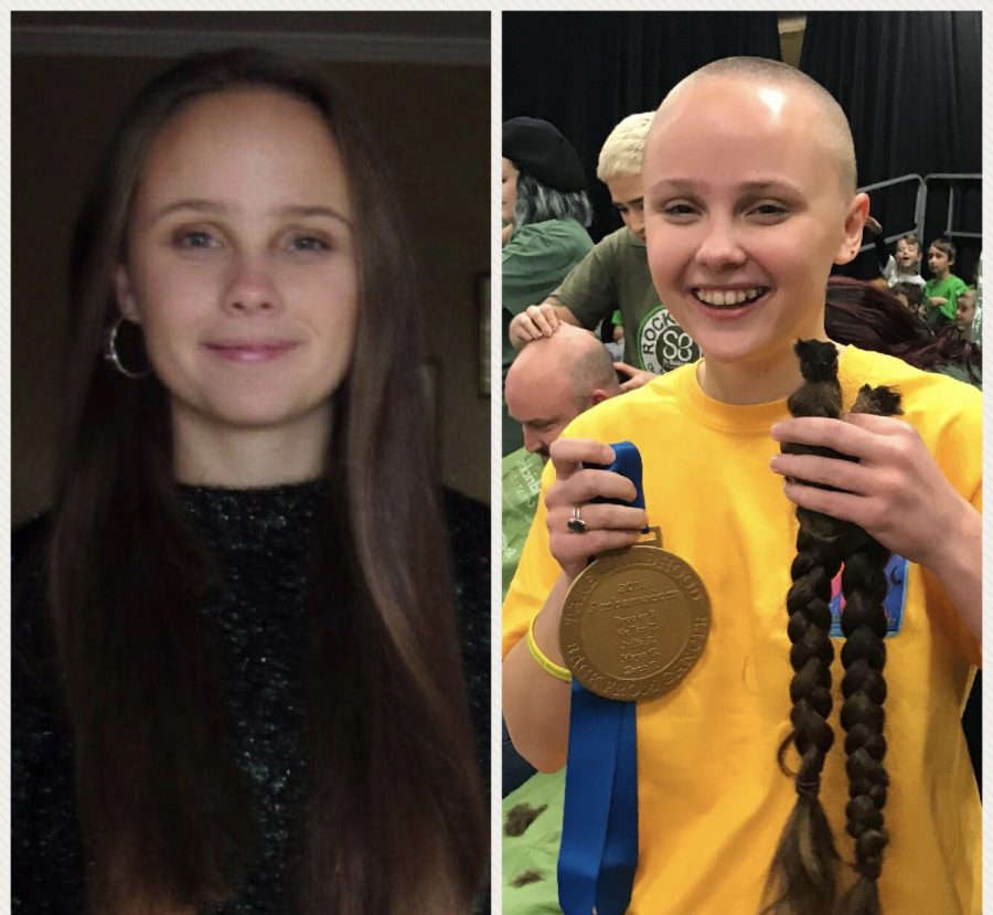 A before and after shot of Meg, who had her head shaved for St. Baldricks to help raise money for childhood cancer.
