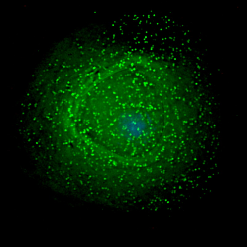 Viral particles assembling around an infected immune cell.